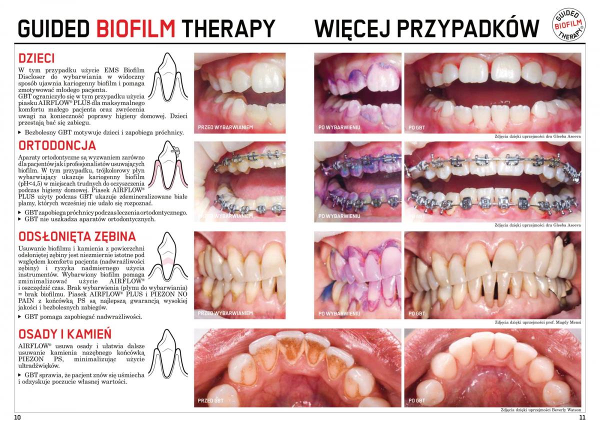 Gabinet-Stomatologiczny-broszura-14