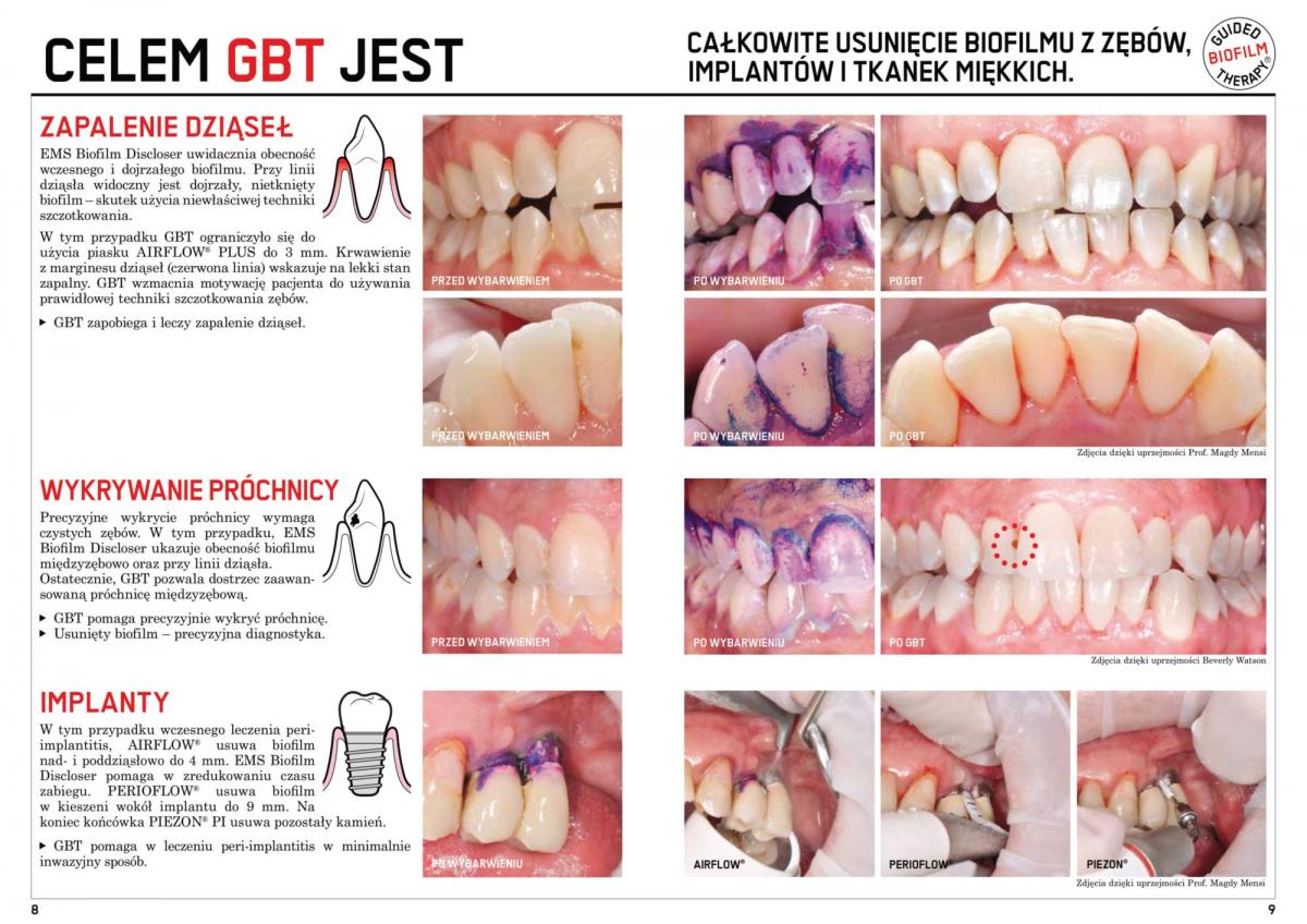 Gabinet-Stomatologiczny-broszura-15